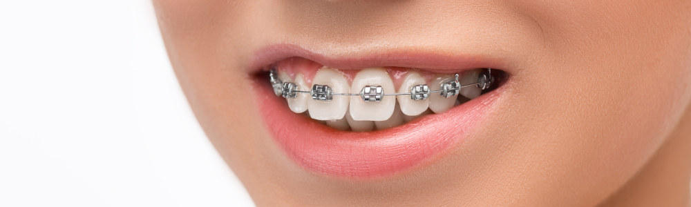 orthodontiste toulon